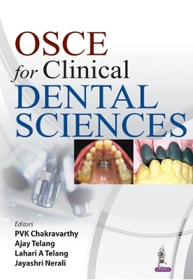 OSCE for Clinical Dental Sciences - Pvk Chakravarthy, Ajay Telang, Lahari A Telang, Jayashri Nerali