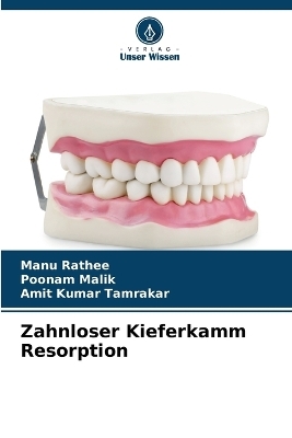 Zahnloser Kieferkamm Resorption - Manu Rathee, Poonam Malik, Amit Kumar Tamrakar