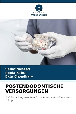 Postendodontische Versorgungen