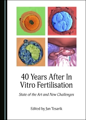 40 Years After In Vitro Fertilisation - 