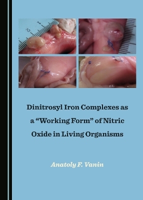 Dinitrosyl Iron Complexes as a &ldquo;Working Form&rdquo; of Nitric Oxide in Living Organisms - Anatoly F. Vanin