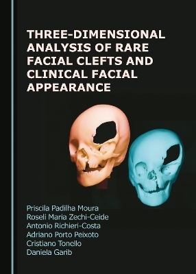Three-Dimensional Analysis of Rare Facial Clefts and Clinical Facial Appearance - Priscila Padilha Moura, Roseli Maria Zechi-Ceide, Antonio Richieri-Costa