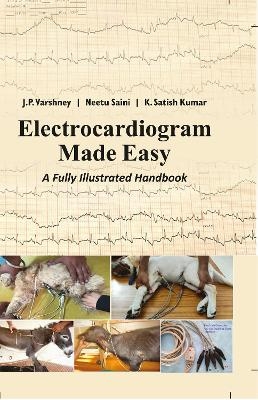 Electrocardiogram Made Easy