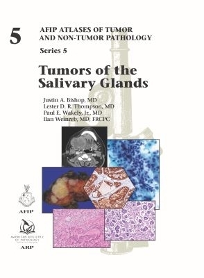 Tumors of the Salivary Glands - Justin A. Bishop, Lester D. R. Thompson, Paul E. Wakely Jr., Ilan Weinreb