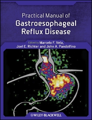 Practical Manual of Gastroesophageal Reflux Disease - MF Vela