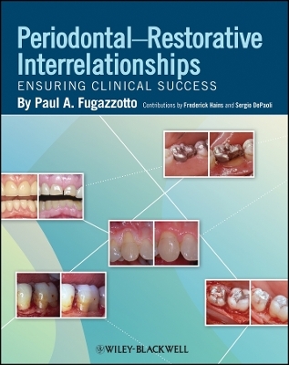 Periodontal Restorative Interrelationships - PA Fugazzotto