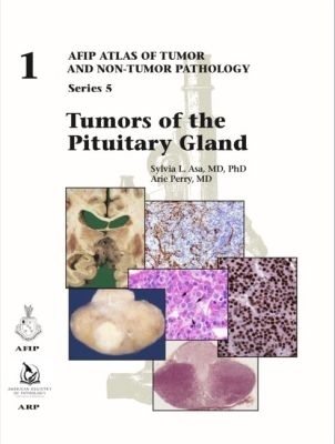 Tumors of the Pituitary Gland - Sylvia L. Asa, Arie Perry