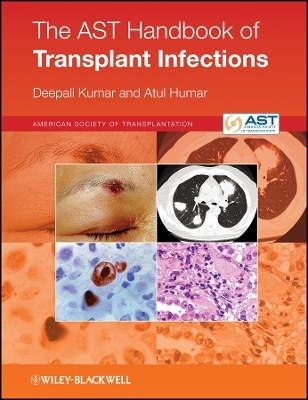 AST Handbook of Transplant Infections - Deepali Kumar, Atul Humar