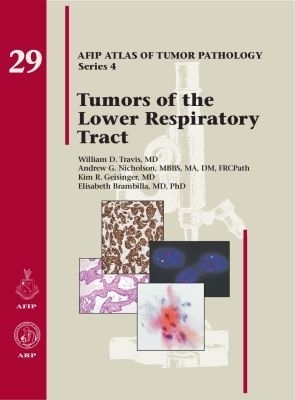 Tumors of the Lower Respiratory Tract - William D. Travis, Andrew G. Nicholson, Kim R. Geisinger, Elisabeth Brambilla