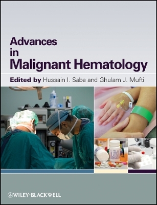 Malignant Hematology a Pract Guide - 