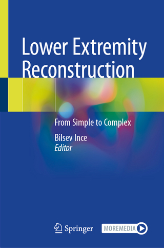 Lower Extremity Reconstruction