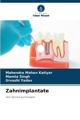 Zahnimplantate - MAHENDRA MOHAN KATIYAR, Mamta Singh, URVASHI YADAV