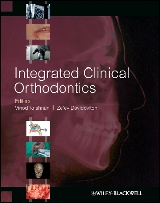 Integrated Clinical Orthodontics - Z Krishnan