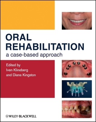 Oral Rehabilitation &ndash; A Case&ndash;Based Approach - I Klineberg