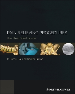 Pain–Relieving Procedures: The Illustrated Guide