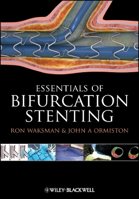 Bifurcation Stenting