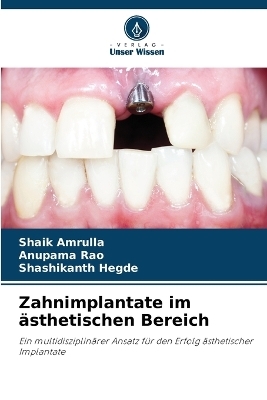 Zahnimplantate im &auml;sthetischen Bereich - Shaik Amrulla, Anupama Rao, Shashikanth Hegde