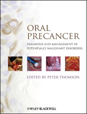 Oral Precancer - P THOMSON