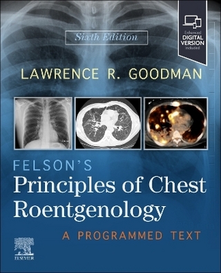 Felson's Principles of Chest Roentgenology