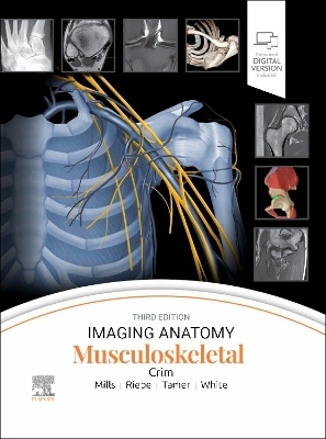 Imaging Anatomy: Musculoskeletal