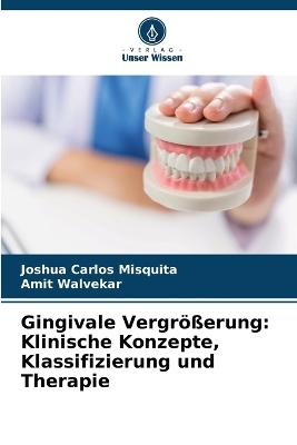 Gingivale Vergr&ouml;&szlig;erung - Joshua Carlos Misquita, Amit Walvekar