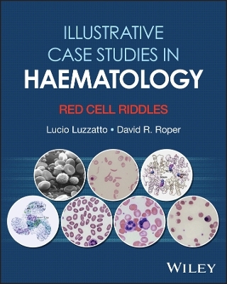 Illustrative Case Studies in Haematology - Lucio Luzzatto, David R. Roper