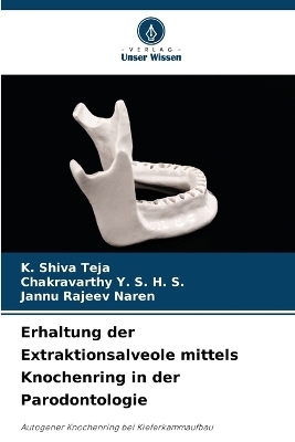 Erhaltung der Extraktionsalveole mittels Knochenring in der Parodontologie - K Shiva Teja, Chakravarthy Y S H S, JANNU RAJEEV NAREN