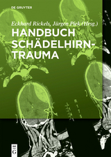 Handbuch Sch&auml;delhirntrauma - 