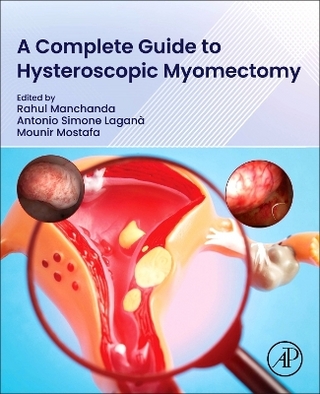 A Complete Guide to Hysteroscopic Myomectomy
