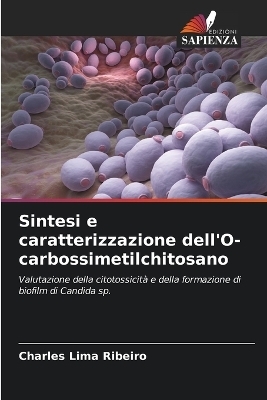 Sintesi e caratterizzazione dell'O-carbossimetilchitosano - Charles Lima Ribeiro