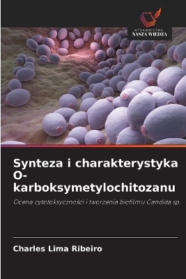 Synteza i charakterystyka O-karboksymetylochitozanu