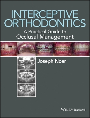 Interceptive Orthodontics – A Practical Guide to Occlusal Management