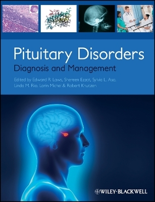 Pituitary Disorders – Diagnosis and Management