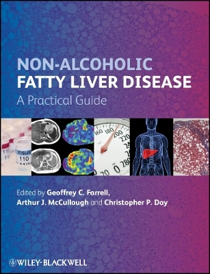 Non–Alcoholic Fatty Liver Disease – A Practical Guide