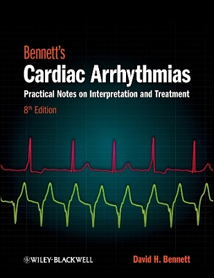 Bennett&prime;s Cardiac Arrhythmias &ndash; Practical Notes on  Interpretation and Treatment 8e - DH Bennett