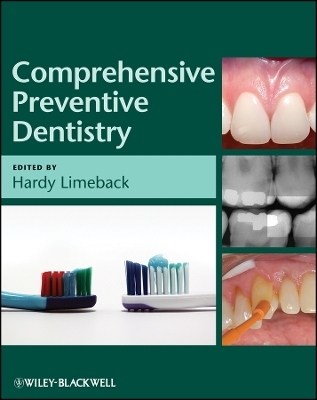 Comprehensive Preventive Dentistry - H Limeback