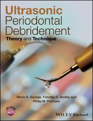 Ultrasonic Periodontal Debridement – Theory and Technique