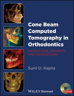 Cone Beam Computed Tomography in Orthodontics &ndash; Indications, Insights, and Innovations - Sunil D. Kapila