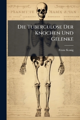 Die Tuberculose Der Knochen Und Gelenke - Franz Konig