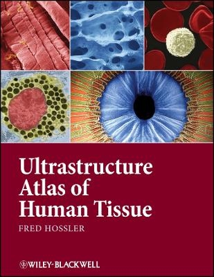Ultrastructure Atlas Of Human Tissues - F Hossler