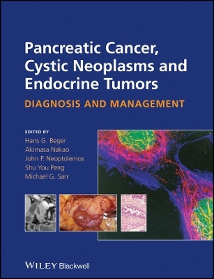 Pancreatic Cancer, Cystic Neoplasms and Endocrine Tumors &ndash; Diagnosis and Management - HG Beger
