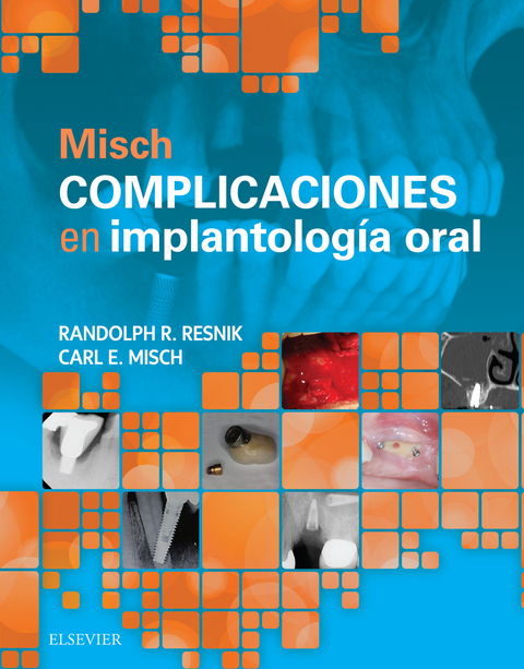 Misch. Complicaciones en implantolog&iacute;a oral -  Carl E. Misch,  Randolph Resnik