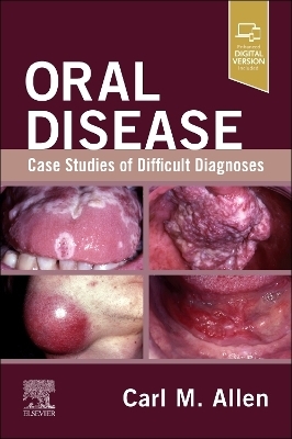 Oral Disease: Case Studies of Difficult Diagnoses - Carl M. Allen