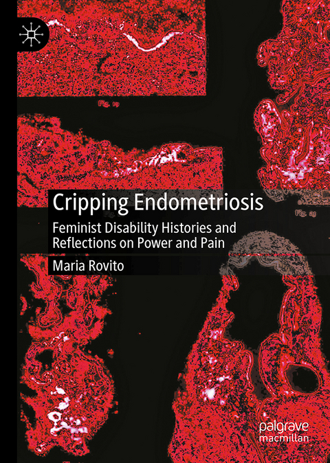 Cripping Endometriosis - Maria Rovito
