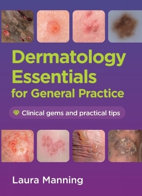 Dermatology Essentials for General Practice - Laura Manning