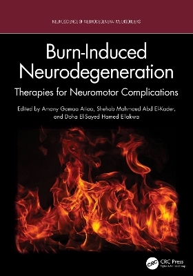Burn-Induced Neurodegeneration - 