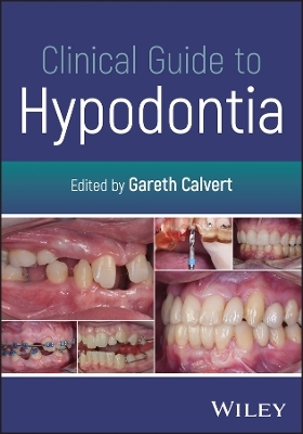 Clinical Guide to Hypodontia - 