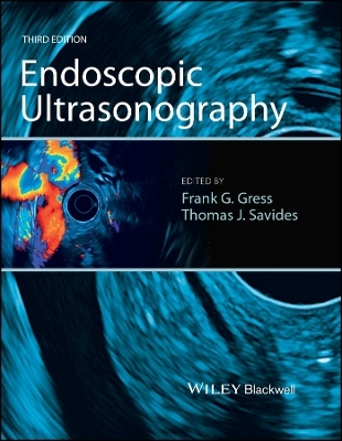 Endoscopic Ultrasonography 3e - 