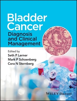 Bladder Cancer &ndash; Diagnosis and Clinical Management - 