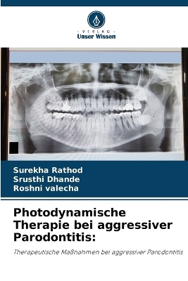 Photodynamische Therapie bei aggressiver Parodontitis - Surekha Rathod, Srusthi Dhande, Roshni valecha